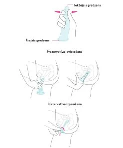 Ormelle Female Condoms (5 Pcs) -Sex Toy Store Prezervativu info5abd2e5c36694